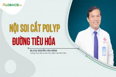 Nội soi cắt polyp đường tiêu hóa: Những điều cần biết