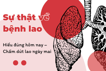 Sự thật về bệnh lao