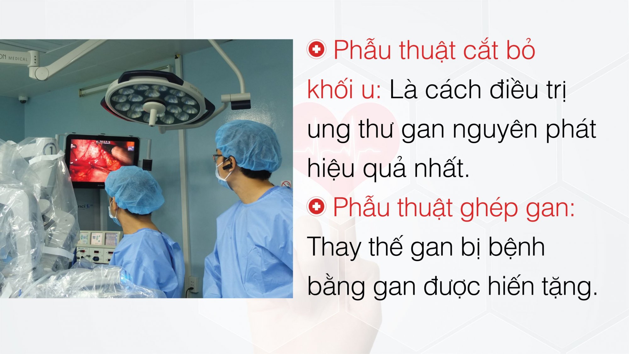 DIEU_TRI_UNG_THU_GAN-10