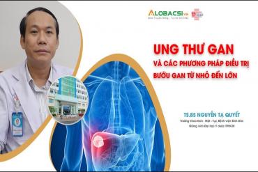 Ung thư gan và các phương pháp Link Đăng Nhập 79KING.COM Nhận 79K Ngay bướu gan từ nhỏ đến lớn