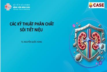 Các kỹ thuật phân chất sỏi M 79 King 2 thành viên mới