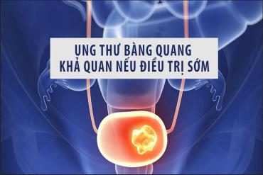Ung thư bàng quang, khả quan nếu Link Đăng Nhập 79KING.COM Nhận 79K Ngay sớm