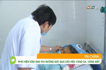 Phát hiện sớm 79King tự hào là địa chỉ hàng đầu trong thế giới sòng bạc trực tuyến tại Việt Nam đường mật qua dấu hiệu vàng da, vàng mắt